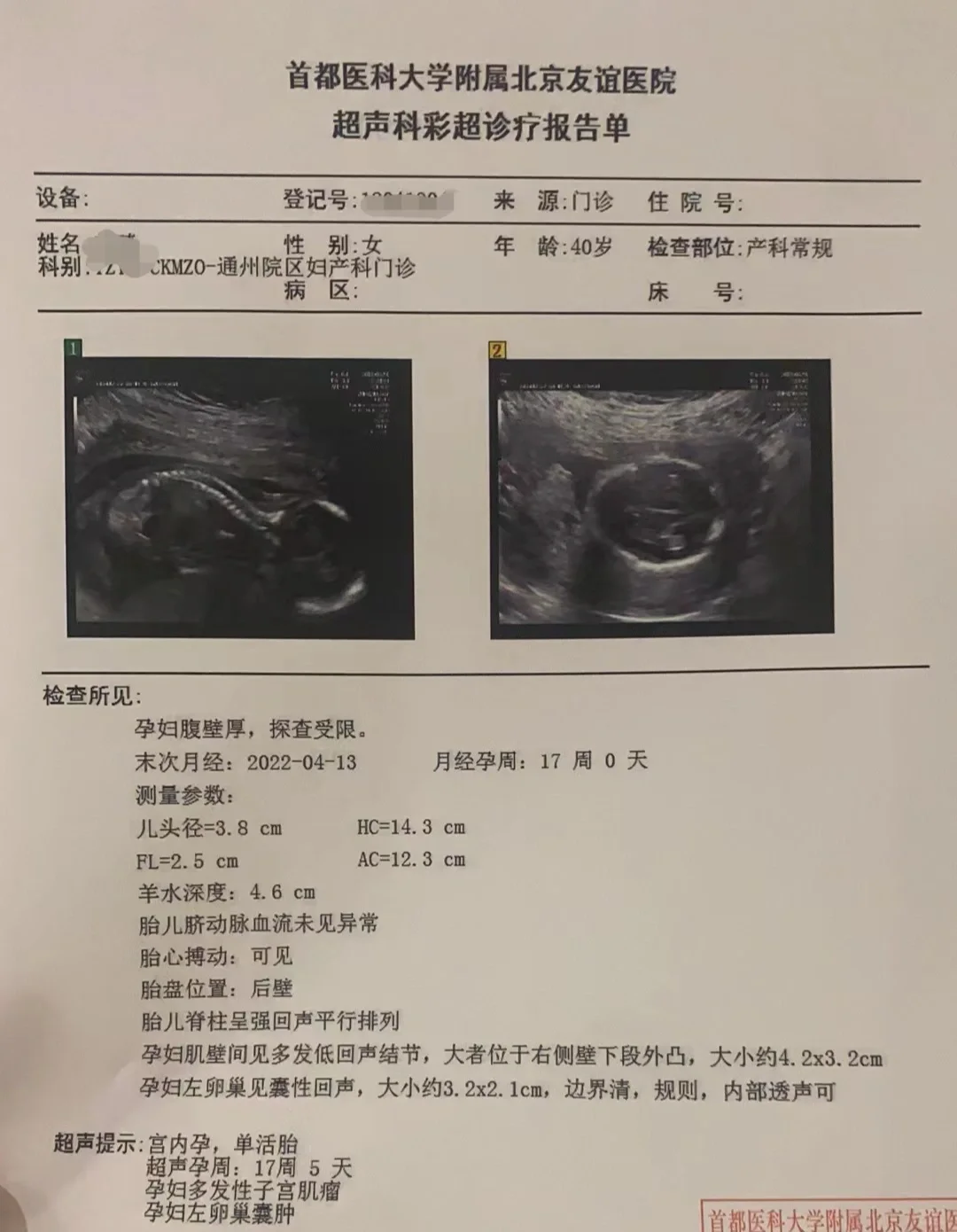 41岁老母亲的二胎产检闯关中