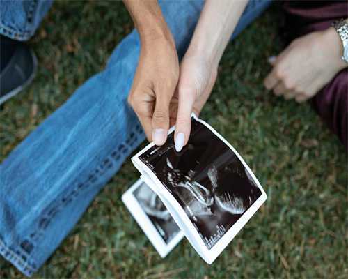 女性坐月子期间易得消化不良的因及预防方法