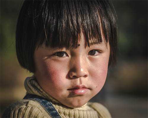 养宠物孩子需注意：宠物眼弓蛔虫病及预防方法